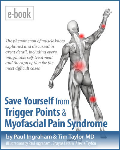 Myofascial physiotherapy device user manual инструкция. Trigger point. trigger point therapy. триггерные точки книга. myofascial physiotherapy device user manual.