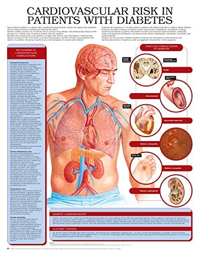 Cardiovascular risk in patients with diabetes e chart: Full illustrated ...