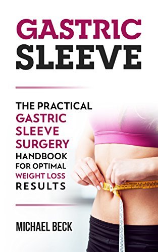 Gastric Sleeve: The Practical Gastric Sleeve Surgery Handbook for Optimal Weight Loss Results
