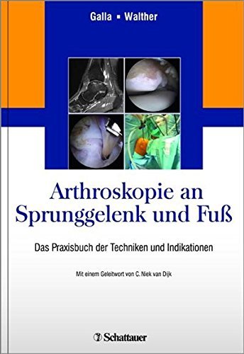 Arthroskopie an Sprunggelenk und Fuß: Das Praxisbuch der Techniken und Indikationen by Mellany ...