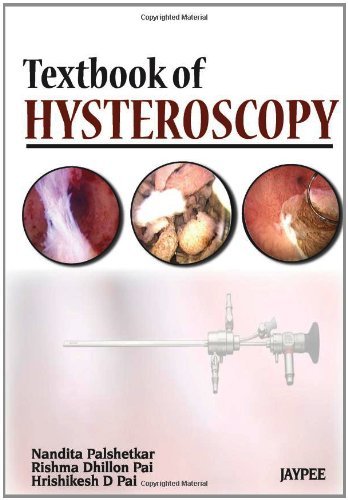 Textbook of Hysteroscopy