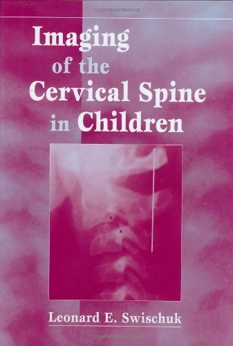 Imaging of the Cervical Spine in Children