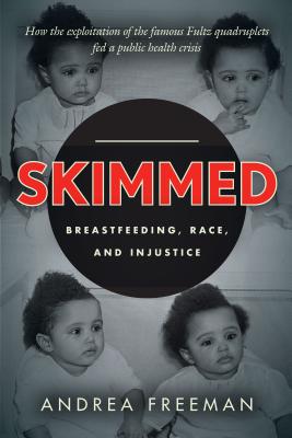 Skimmed: Breastfeeding, Race, and Injustice