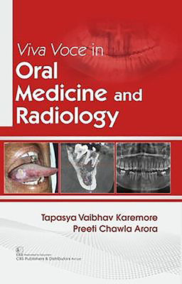 Viva Voce in Oral Medicine and Radiology by Tapasya Vaibhav Karemore ...