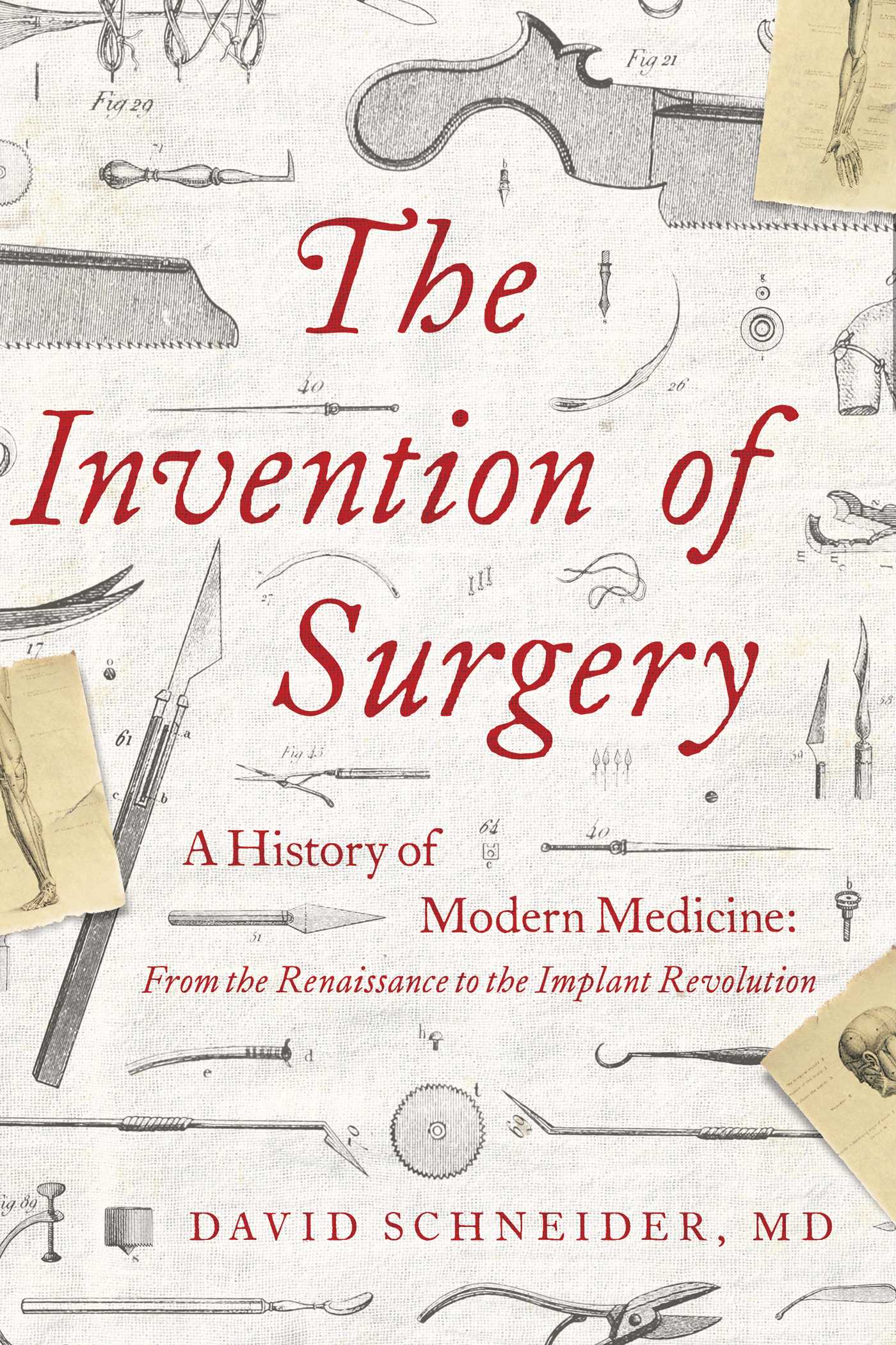 The Invention of Surgery: A History of Modern Medicine: From the Renaissance to the Implant Revolution