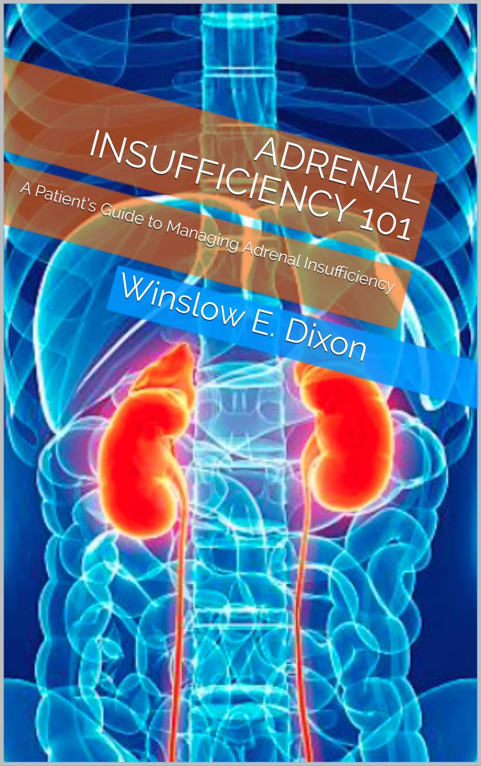 Adrenal Insufficiency 101 A Patient’s Guide to Managing Adrenal