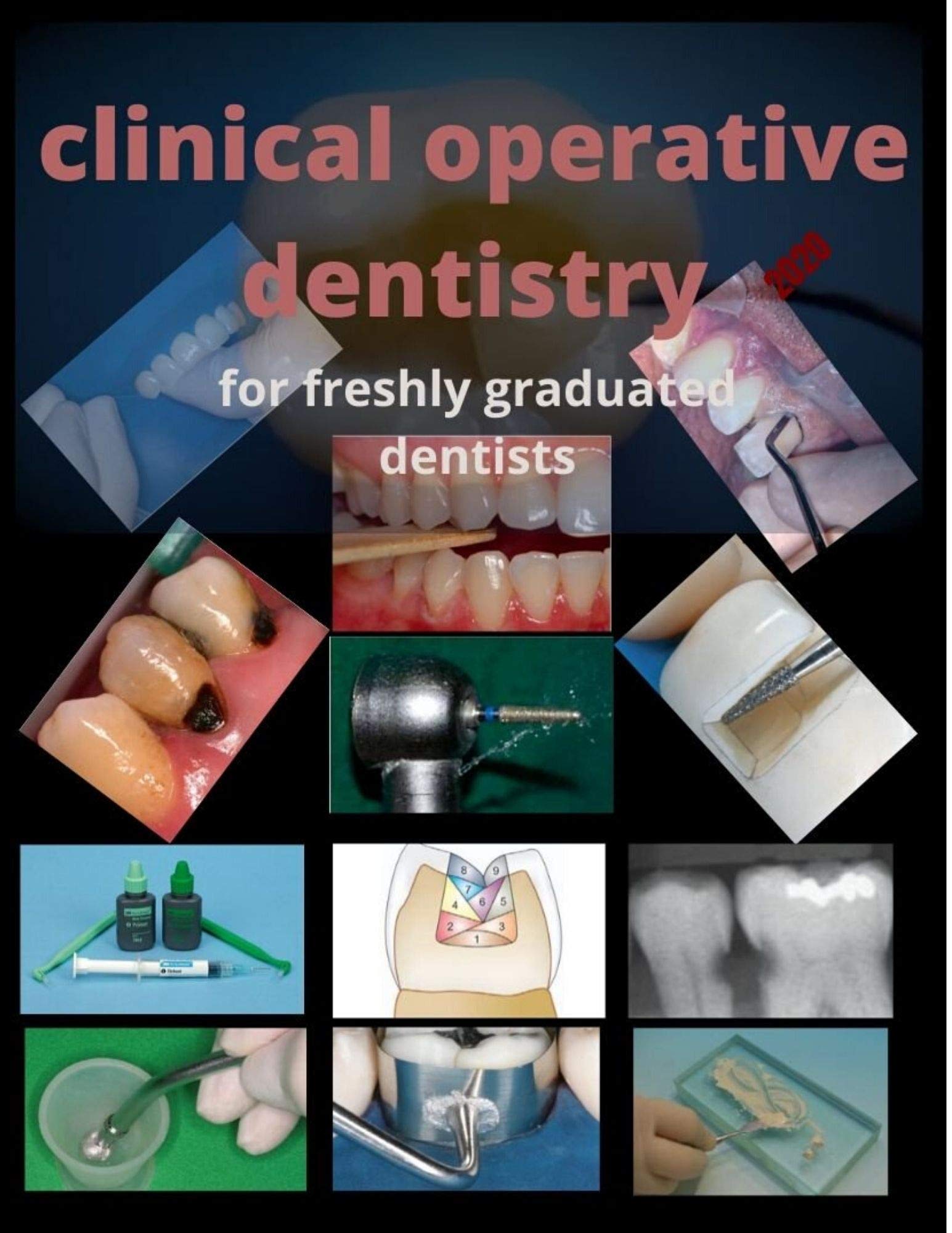 clinical operative dentistry for freshly graduated dentists 2020