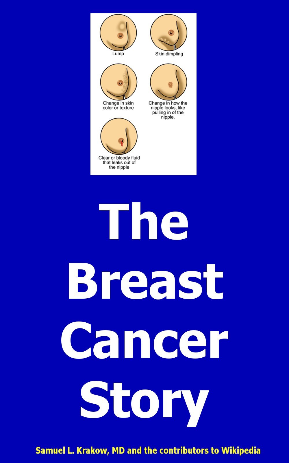 The Breast Cancer Story by Dr. Samuel Krakow Goodreads
