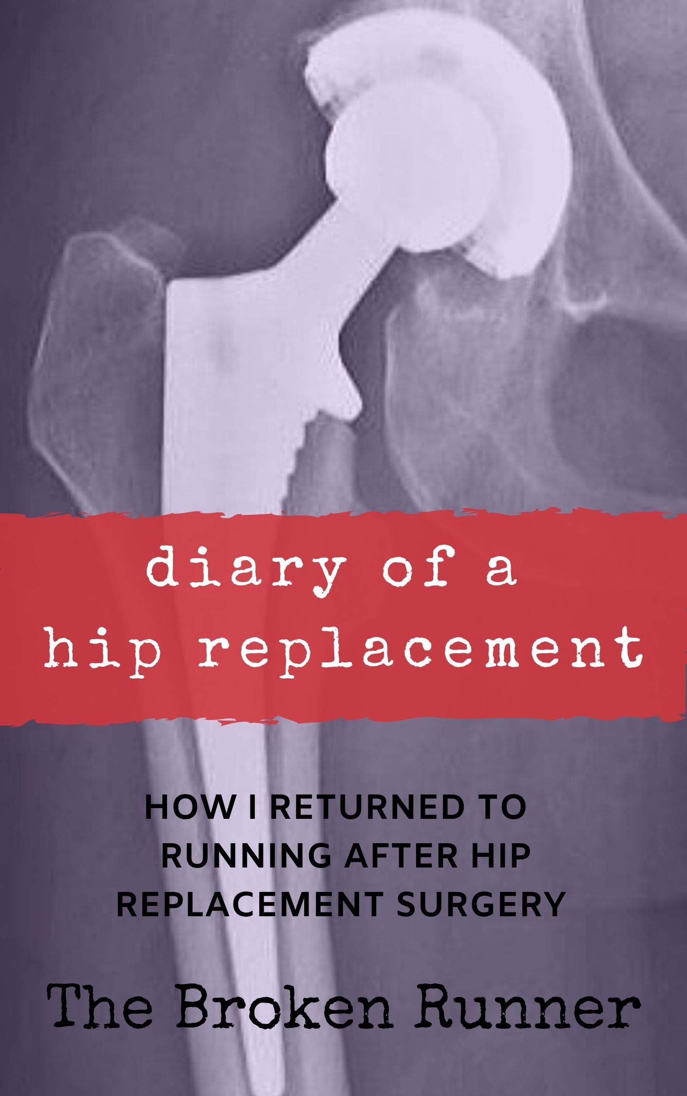 Diary of a Hip Replacement How I returned to running after a hip