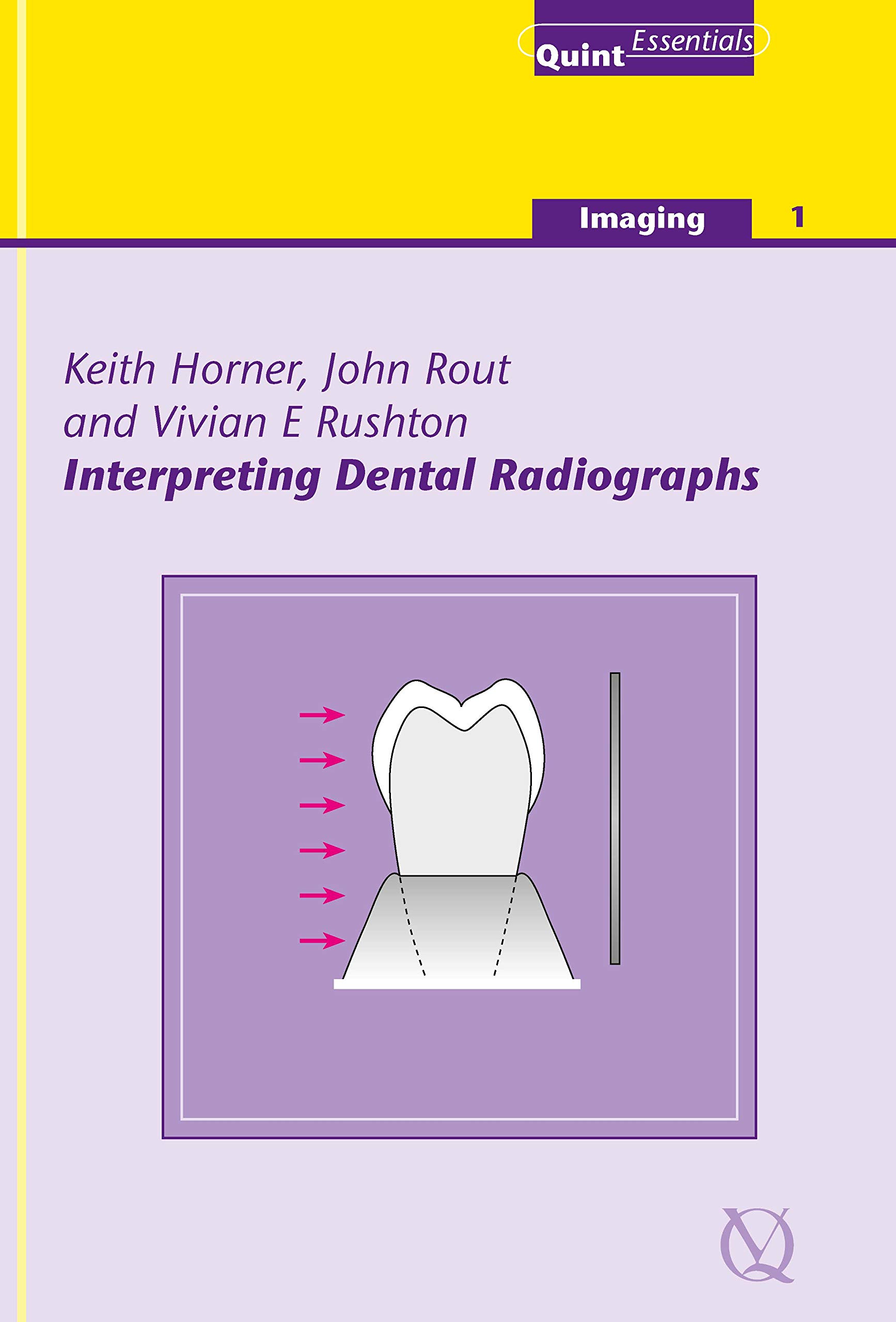 Interpreting Dental Radiographs by Keith Horner Goodreads
