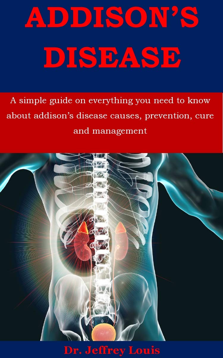 Addison's Disease A Simple Guide on Everything You Need to Know about