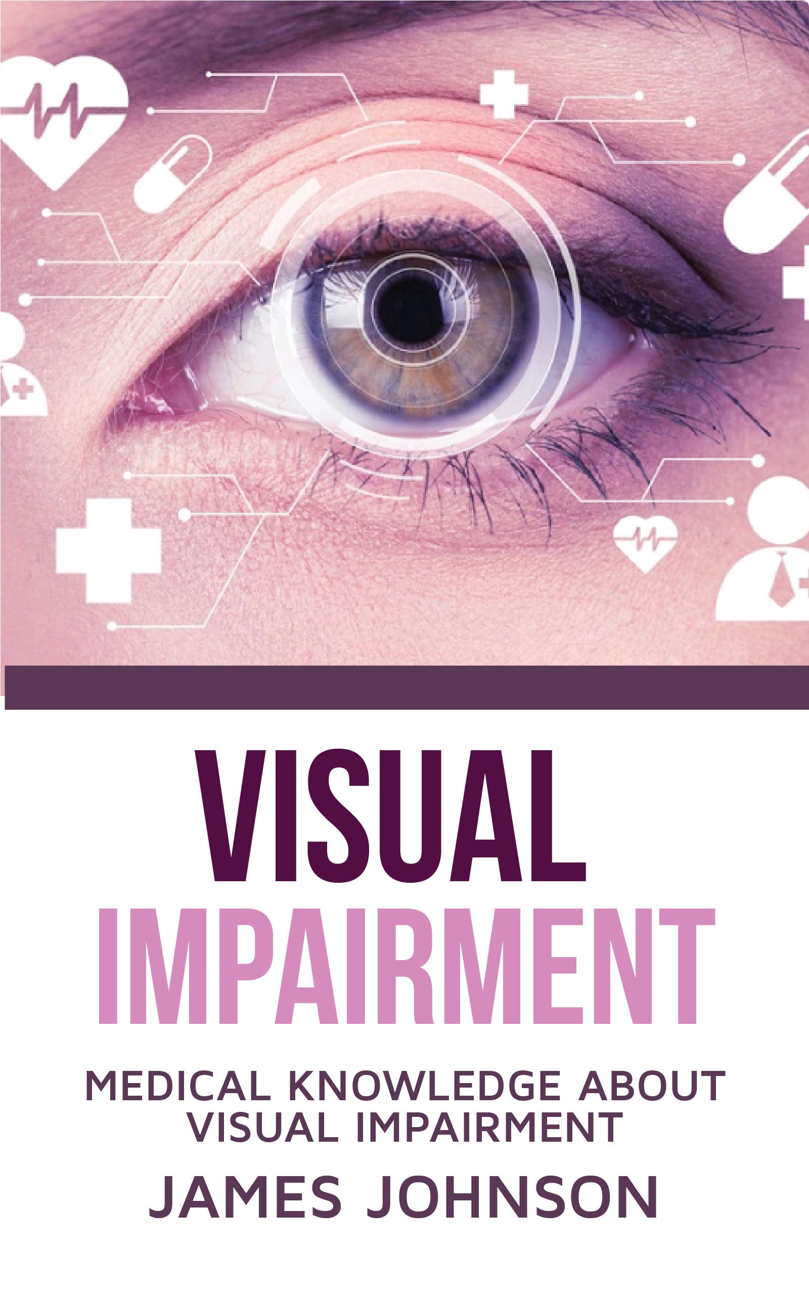 VISUAL IMPAIRMENT MEDICAL KNOWLEDGE ABOUT VISUAL IMPAIRMENT by James