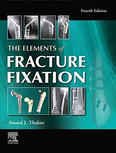 The Elements of Fracture Fixation, 4e