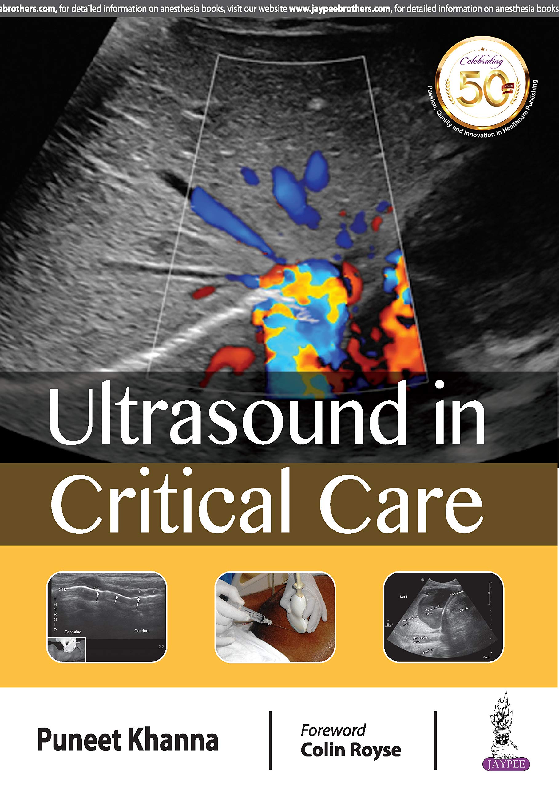Ultrasound in Critical Care