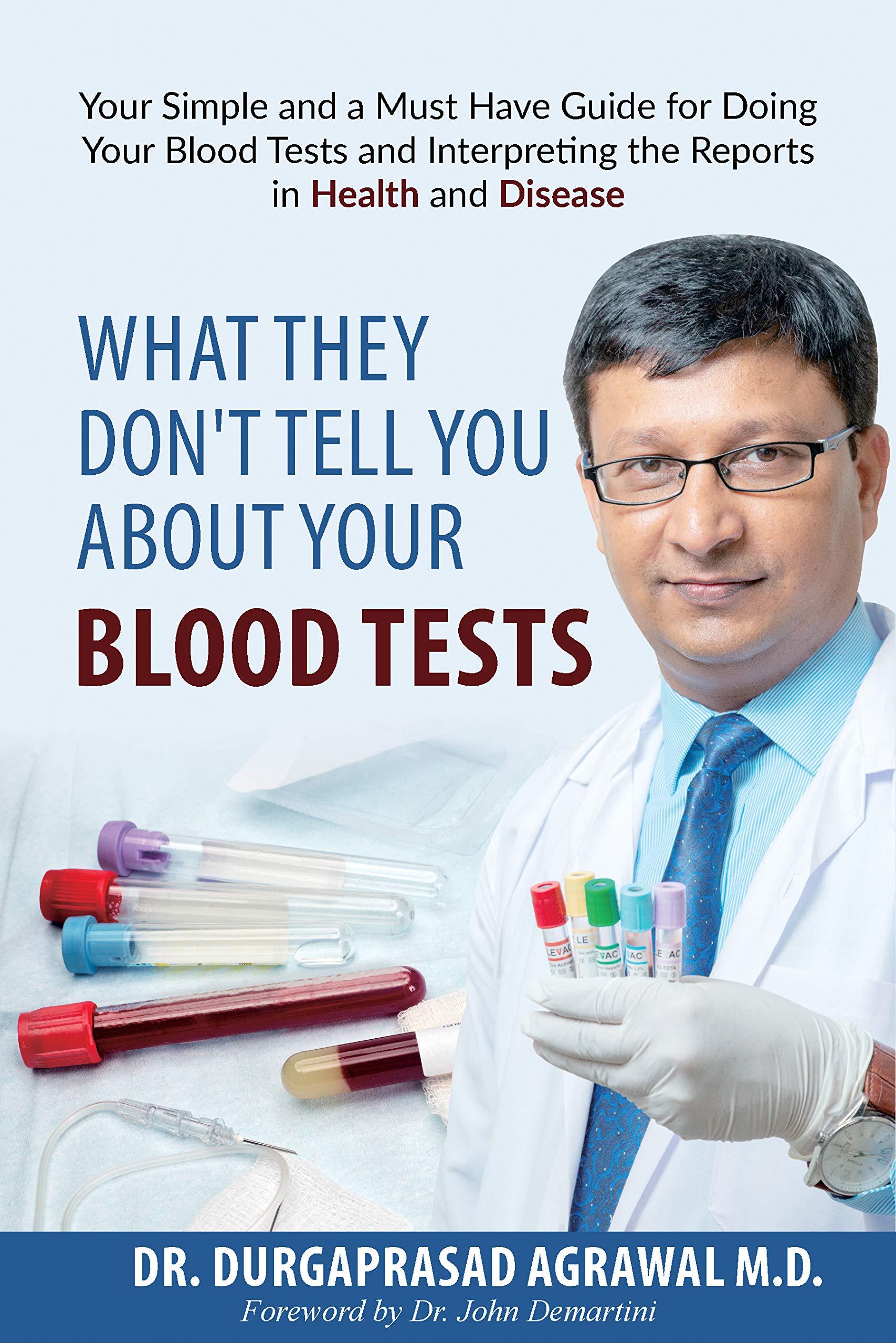 What They Don't Tell You about Your Blood Tests Your simple and a must