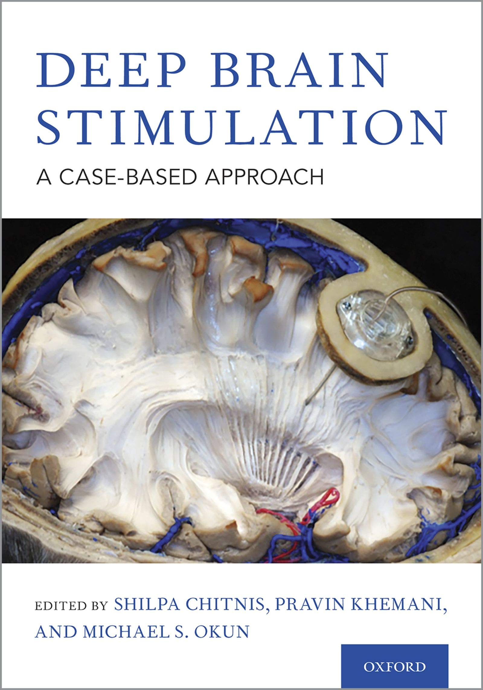 Deep Brain Stimulation: A Case-based Approach by Shilpa Chitnis | Goodreads