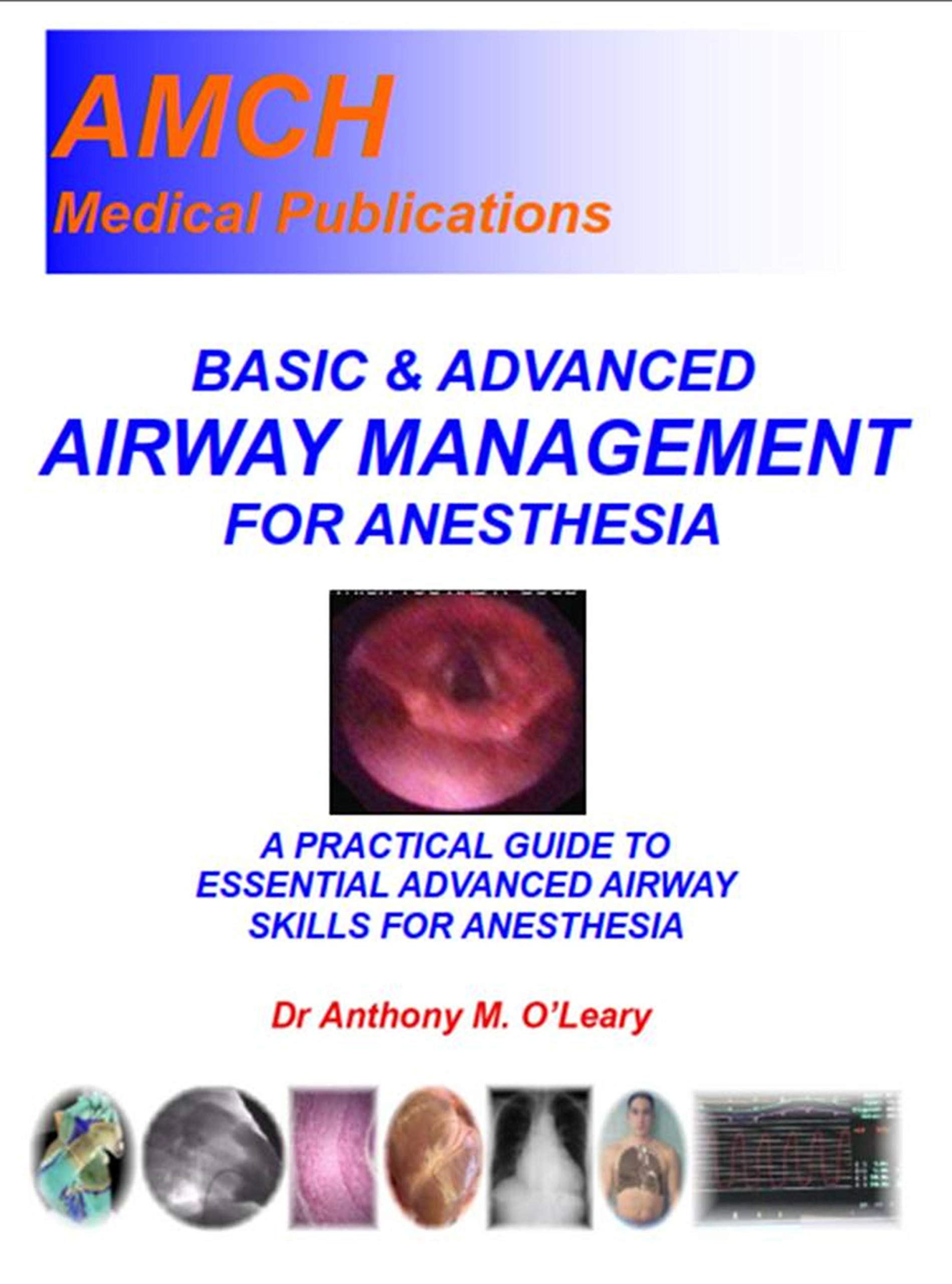 BASIC & ADVANCED AIRWAY MANAGEMENT FOR ANESTHESIA A practical guide to essential advanced