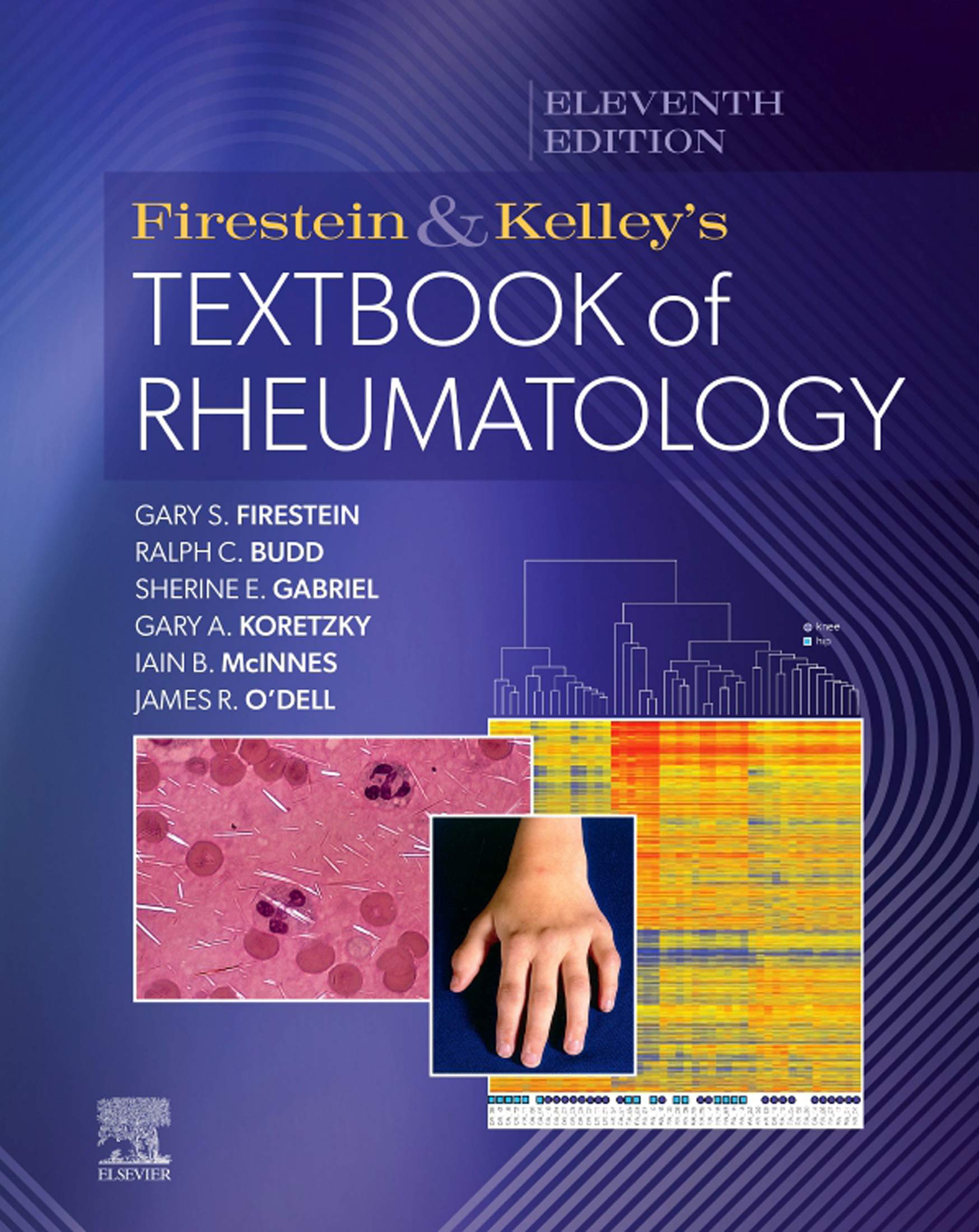 Textbook of Rheumatology 第11版1,2巻セット Firestein & Kelley's Textbook of Rheumatology, 2-Volume Set