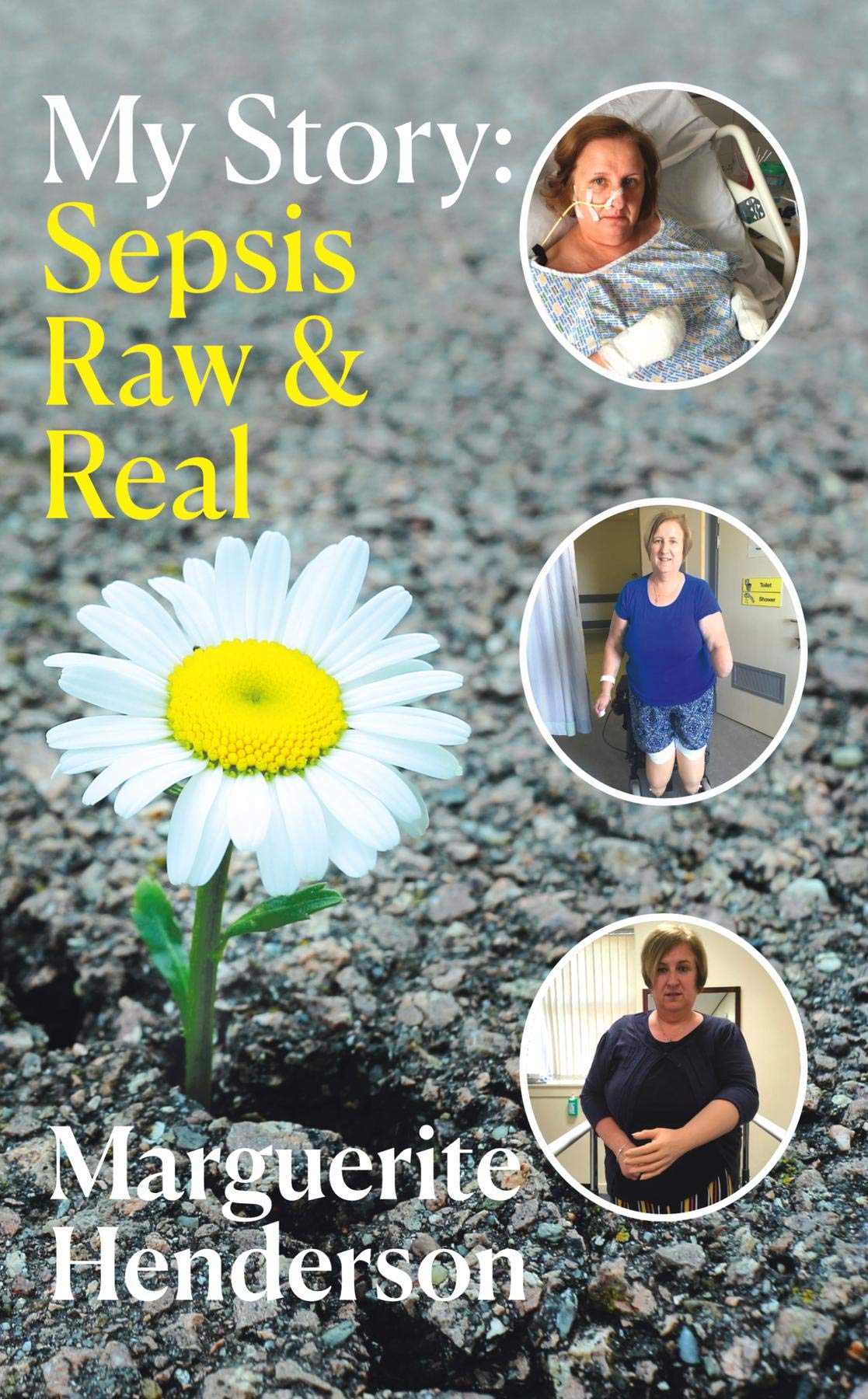 My Story Sepsis Raw and Real by Marguerite Henderson Goodreads