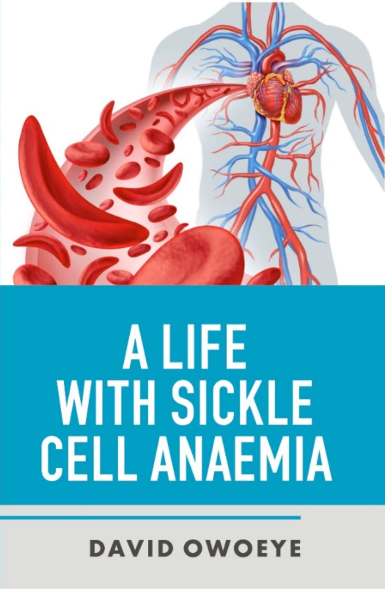 A LIFE WITH SICKLE CELL ANAEMIA by DAVID OWOEYE | Goodreads