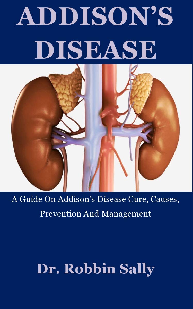 Addison's Disease A Guide On Addison’s Disease Cure, Causes