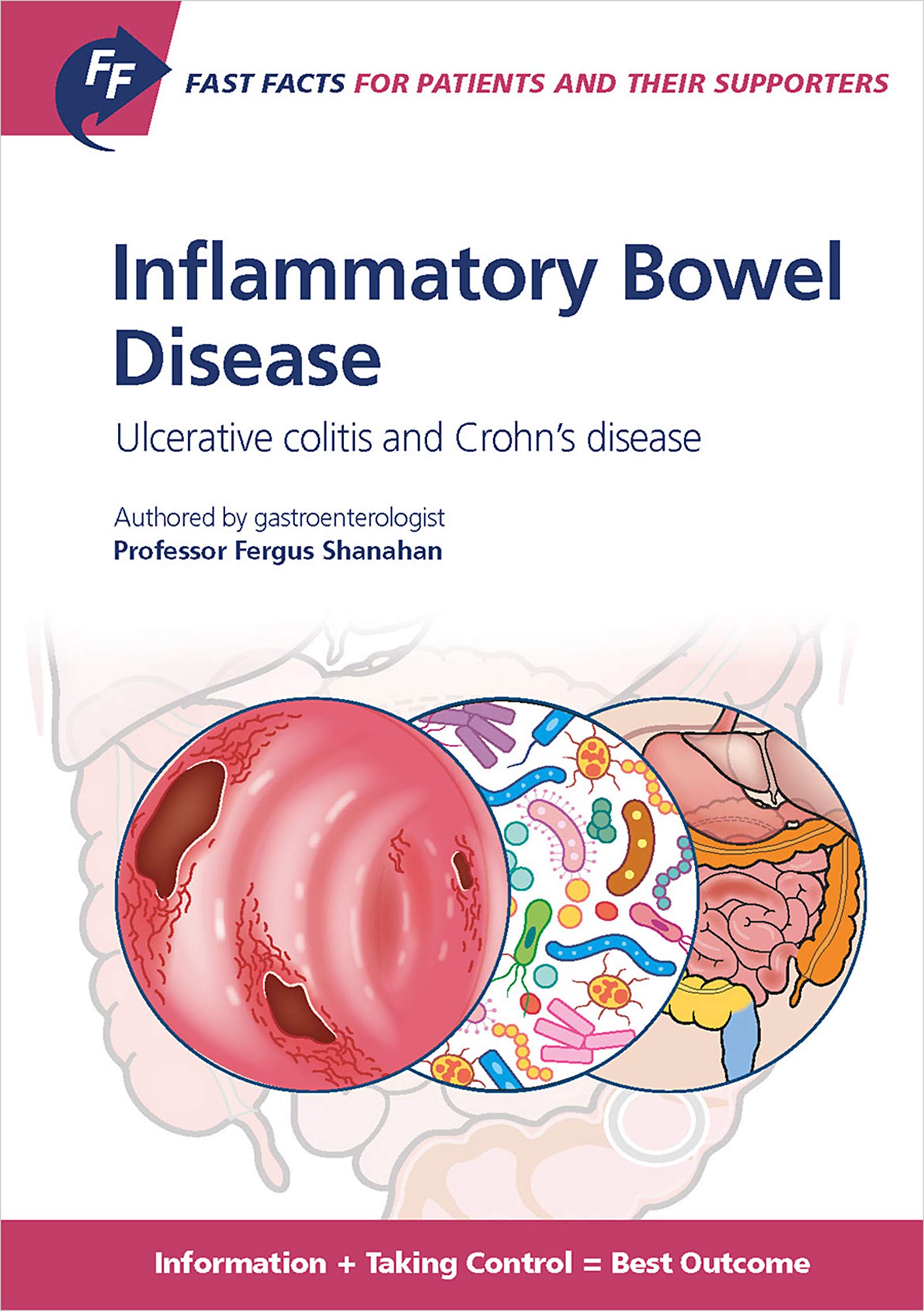 Fast Facts Inflammatory Bowel Disease for Patients and their