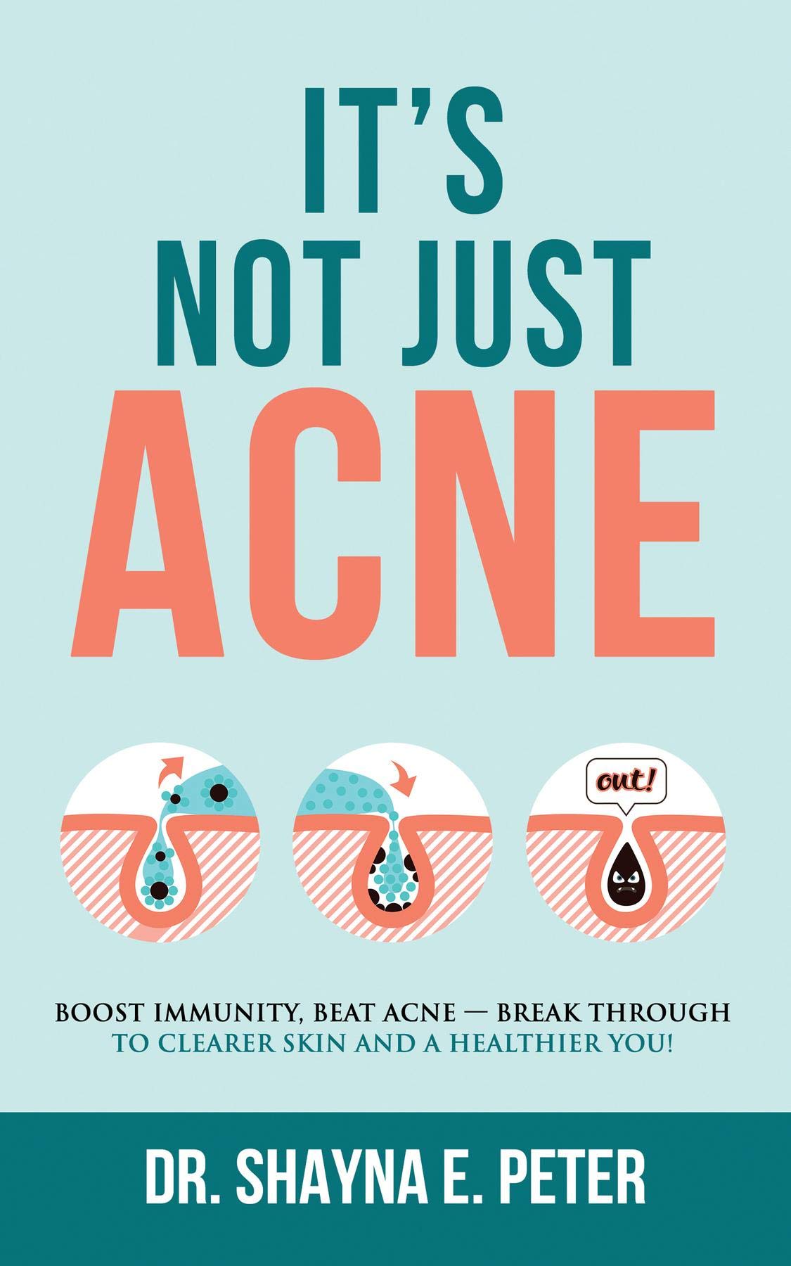It's Not Just Acne: Boost Immunity, Beat Acne - Break Through to Clearer Skin & A Healthier You!