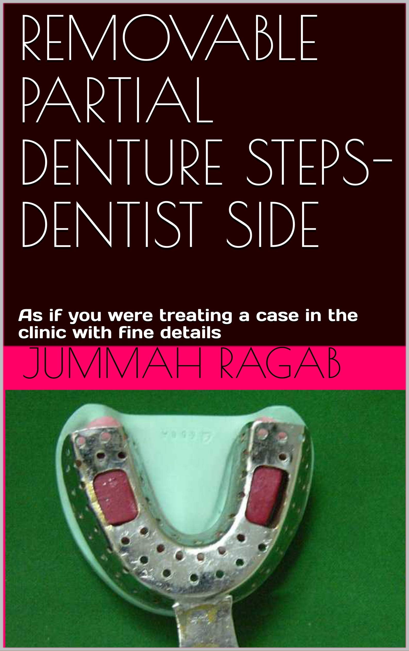 REMOVABLE PARTIAL DENTURE STEPSDENTIST SIDE As if you were treating a
