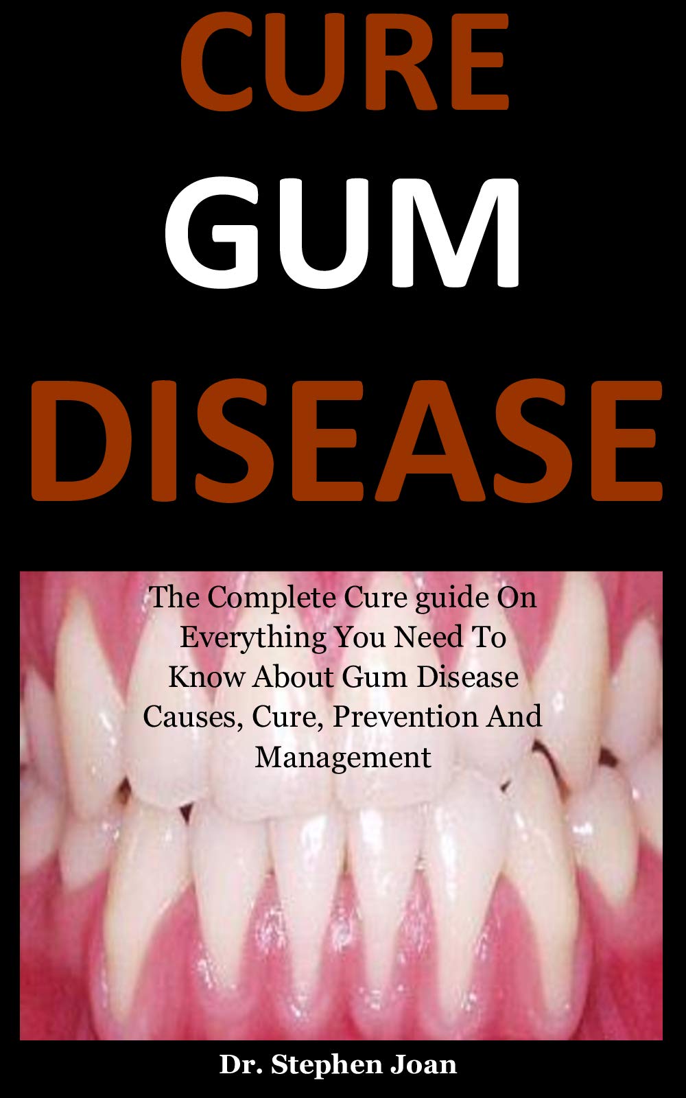 Cure Gum Disease The Complete Cure guide On Everything You Need To