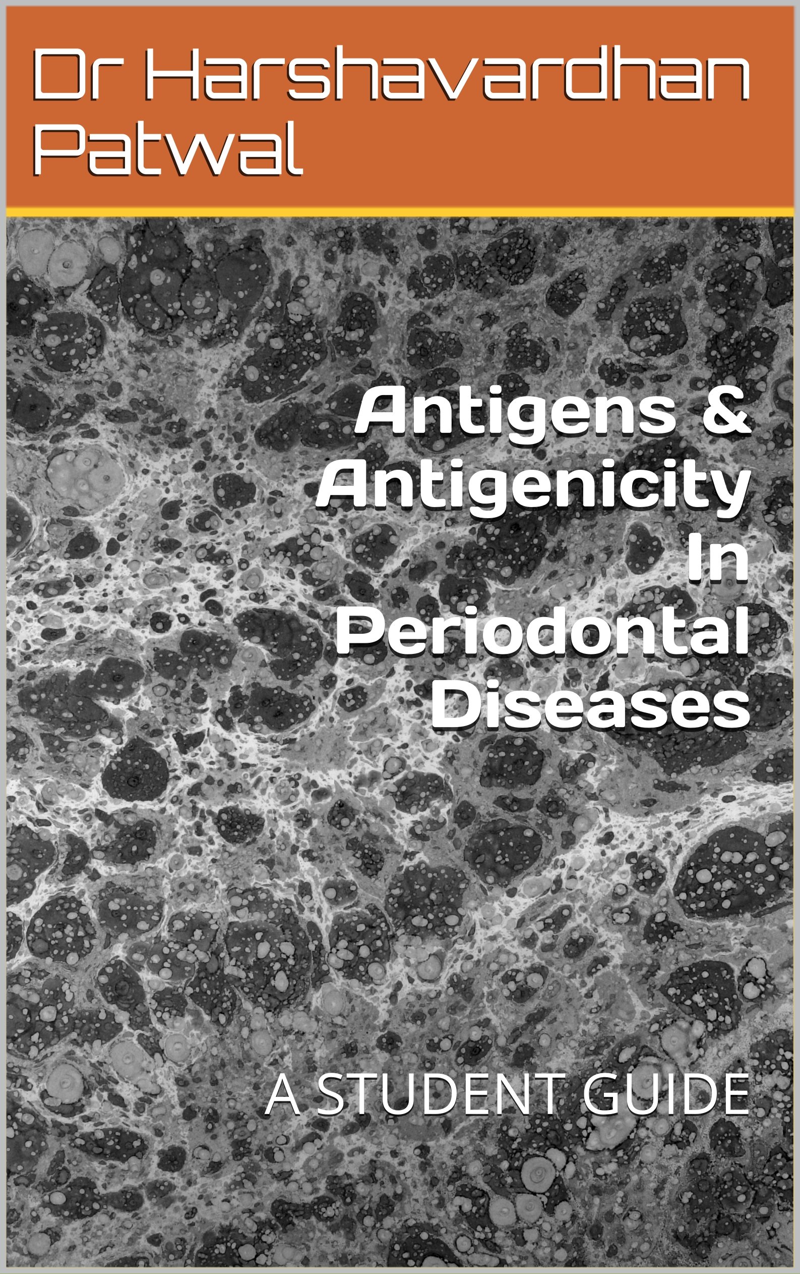 Antigens & Antigenicity In Periodontal Diseases A STUDENT GUIDE by DR