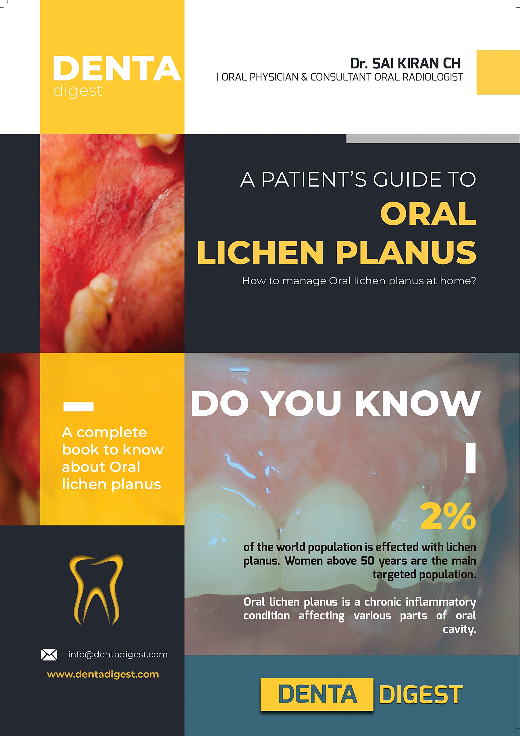 A patient's guide to Oral Lichen Planus by chennoju sai kiran Goodreads