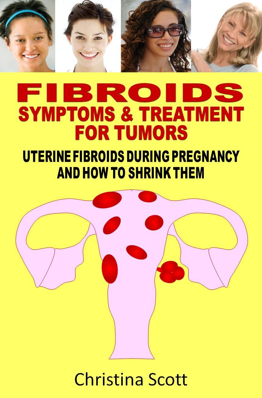 Fibroids Symptoms & Treatment For Tumors Uterine Fibroids Miracle