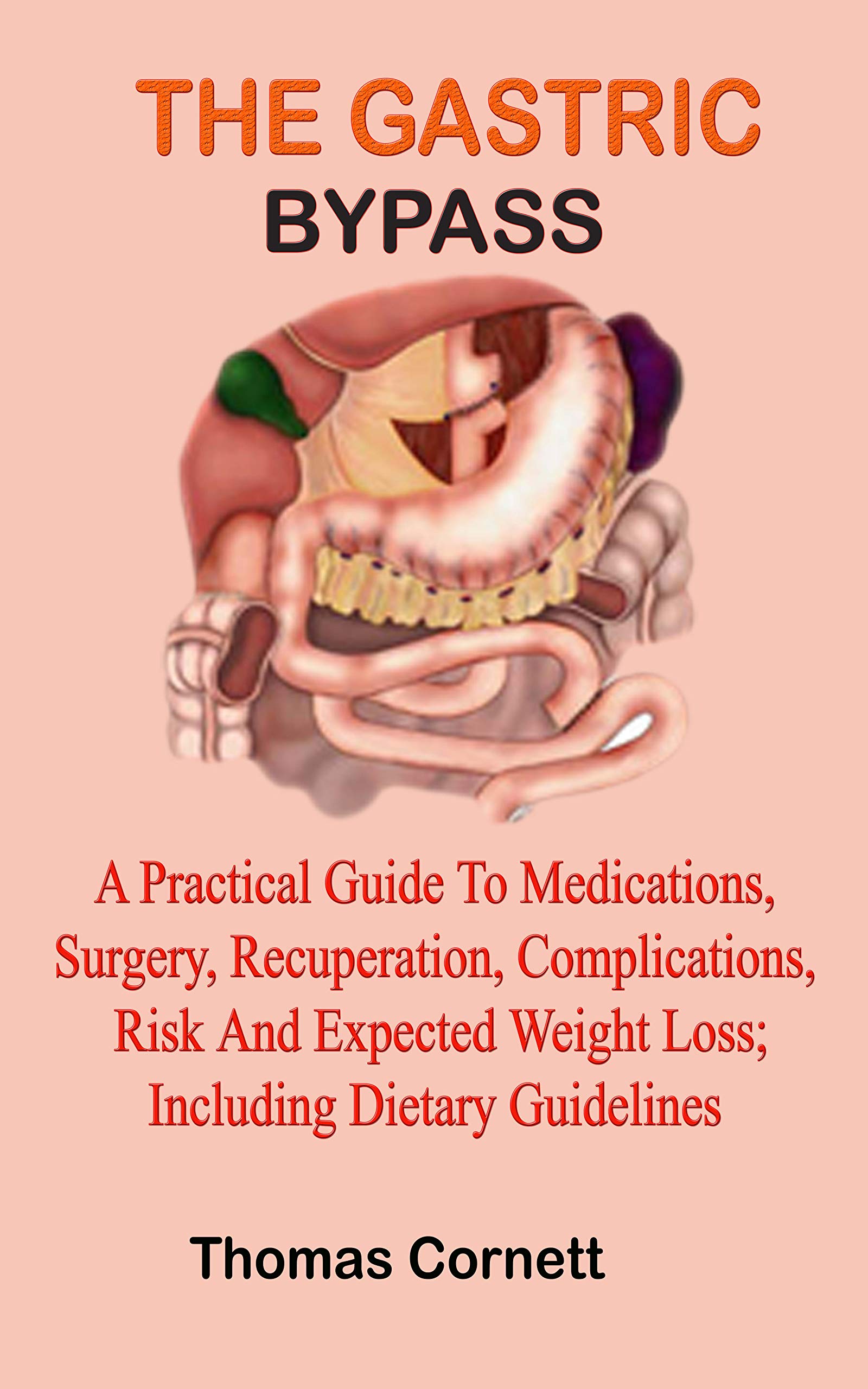 THE GASTRIC BYPASS A Practical Guide to Medications, Surgery