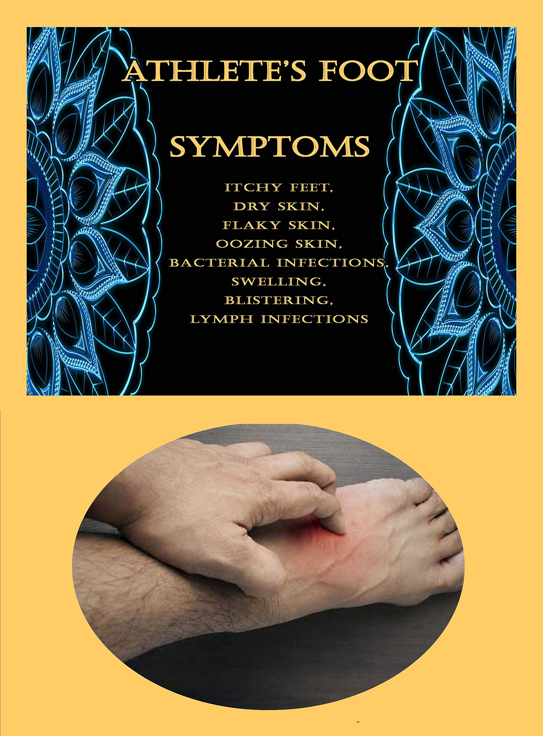 Athlete's Foot Symptoms Itchy Feet, Dry Skin, Flaky Skin, Oozing Skin