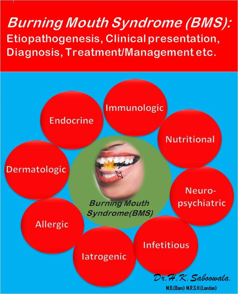 Burning Mouth Syndrome (BMS) Etiopathogenesis, Clinical presentation