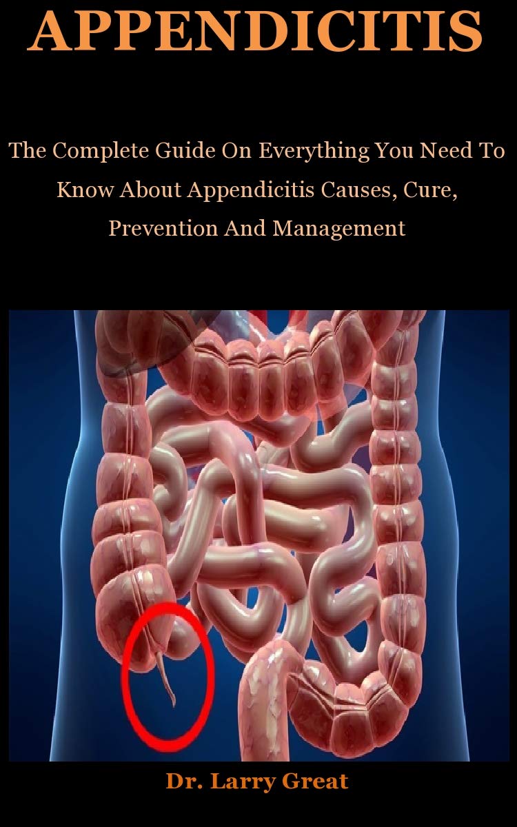 Appendicitis The Complete Guide On Everything You To Need Know About