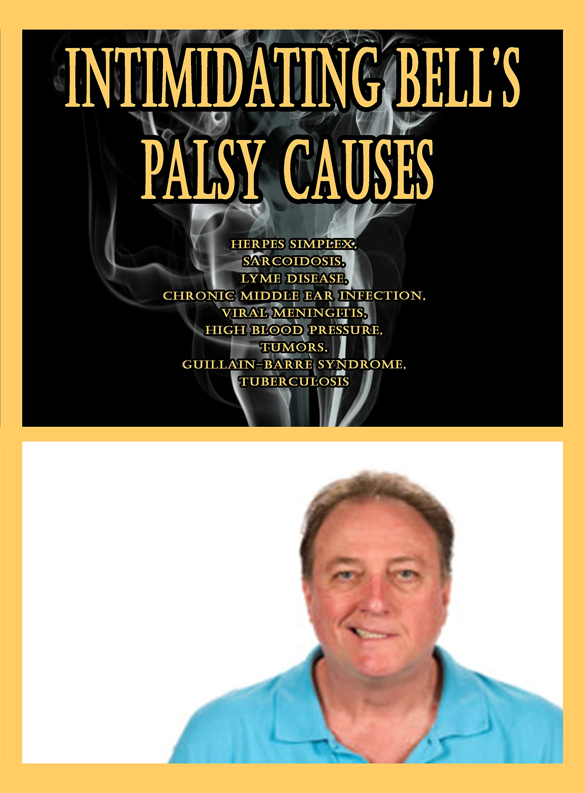 Intimidating Bell’s Palsy Causes Herpes Simplex, Sarcoidosis, Lyme