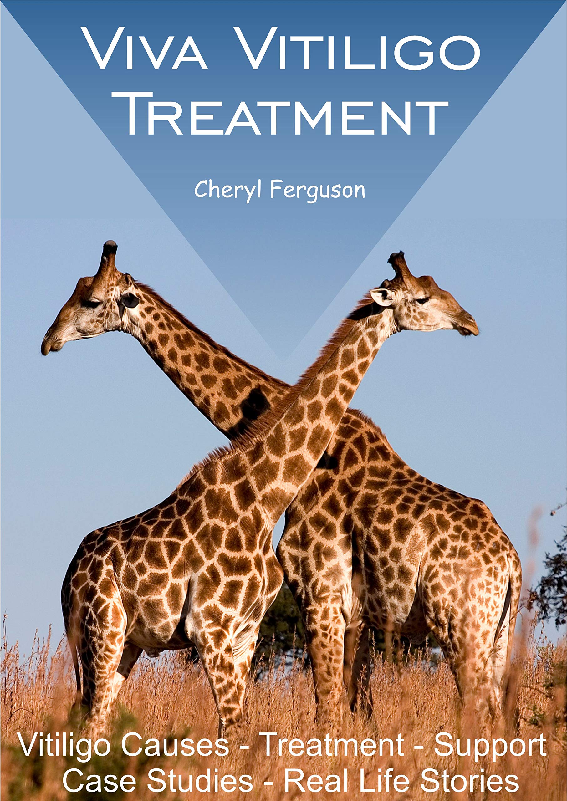 Viva Vitiligo Treatment Vitiligo Causes Treatment Support Case