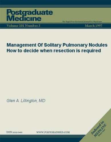 Management Of Solitary Pulmonary Nodules: How to decide when resection