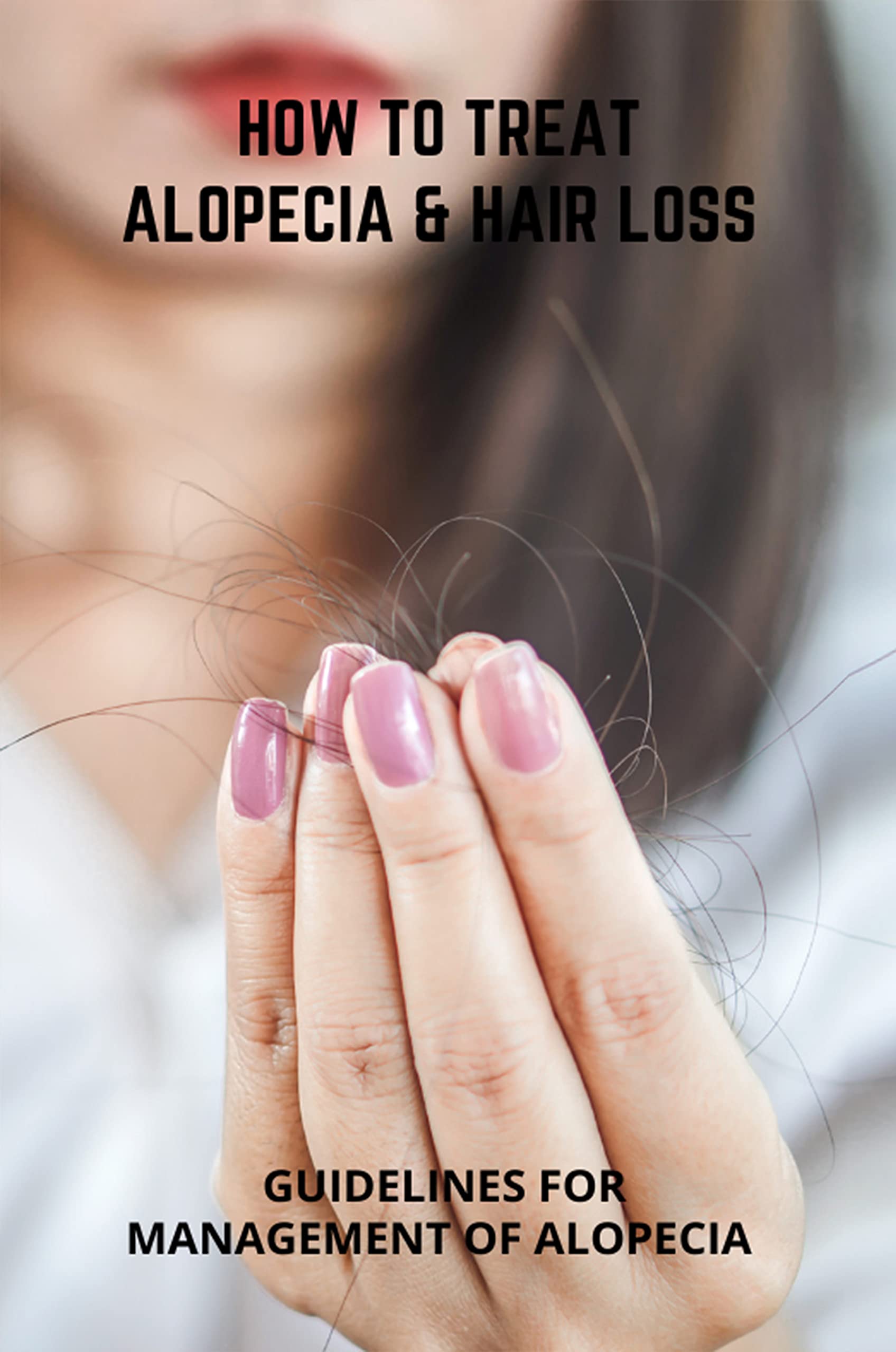 How To Treat Alopecia & Hair Loss Guidelines For Management Of