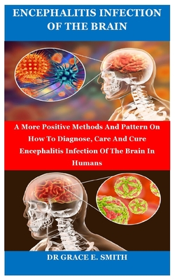 Encephalitis Infection of the Brain: A More Positive Methods And ...