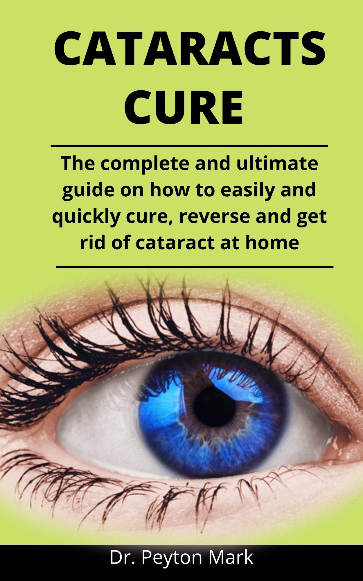 Cataracts Cure The Complete And Ultimate Guide On How To Easily And Quickly Cure, Reverse And