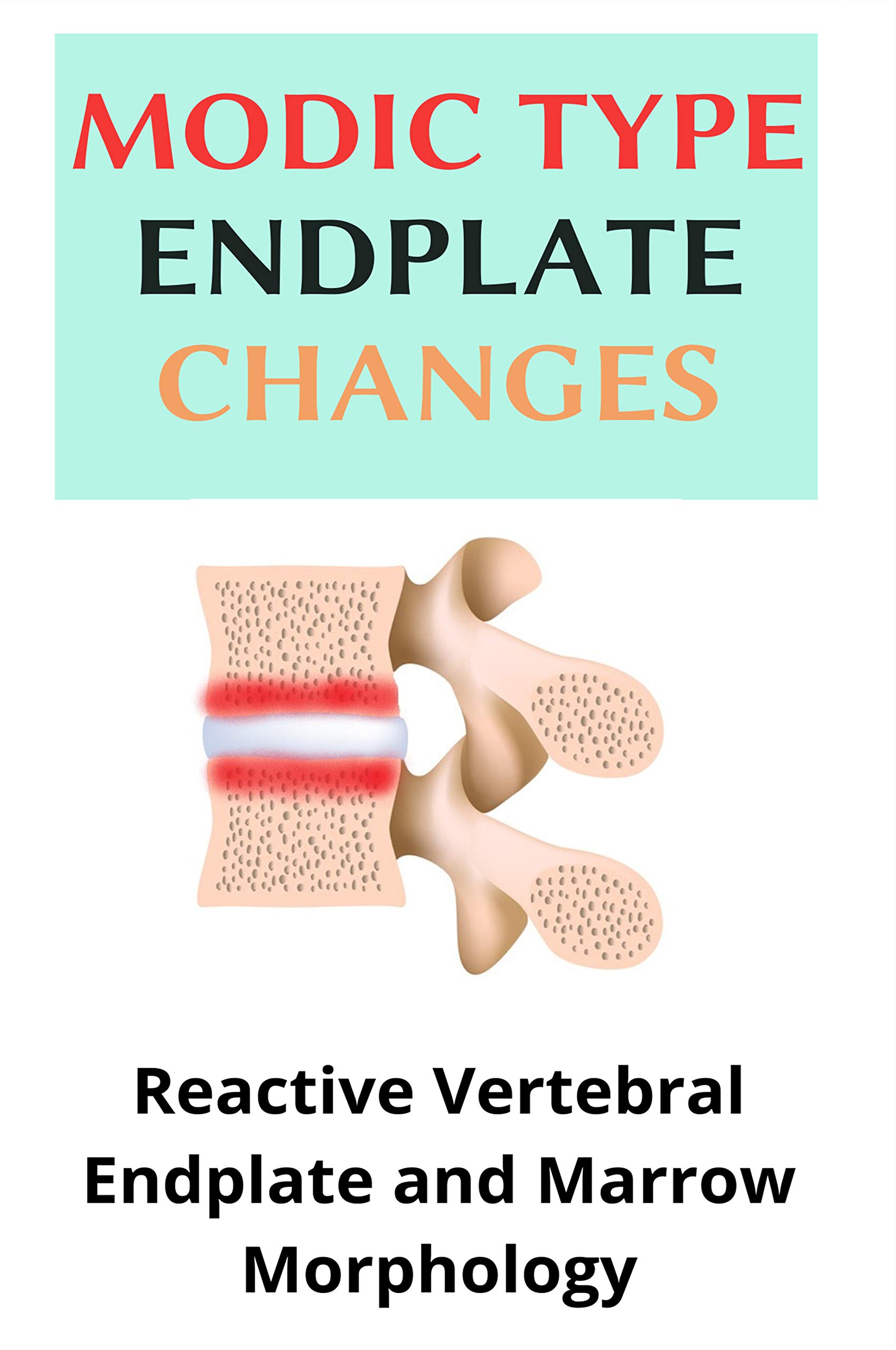 Modic Type Endplate Changes Reactive Vertebral Endplate And Marrow Morphology What Causes