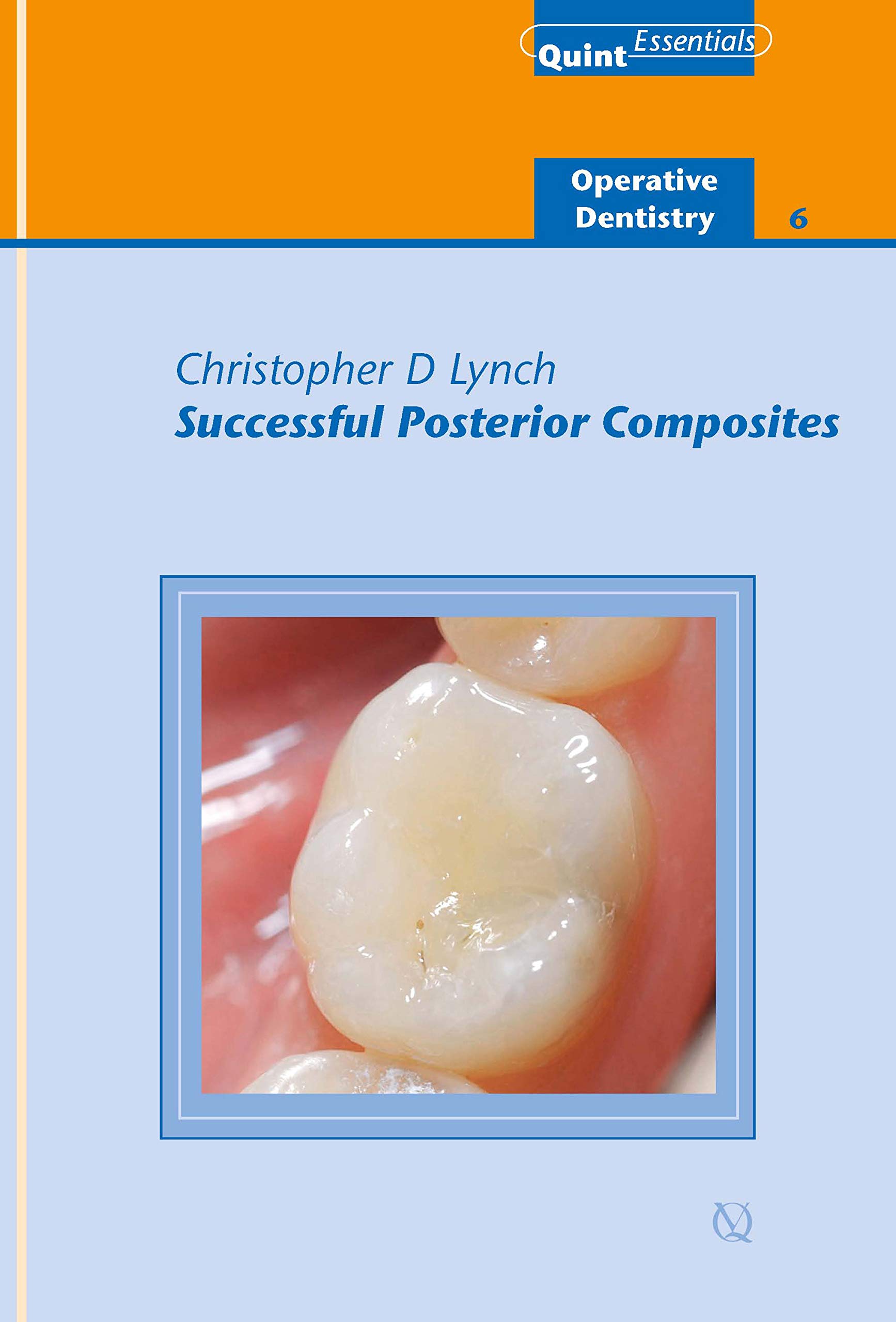 Successful Posterior Composites Operative Dentistry 6 by Christopher