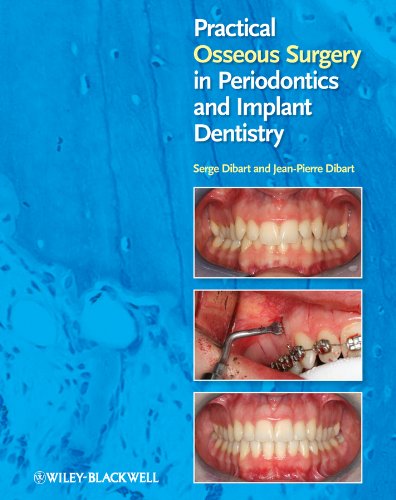 Practical Osseous Surgery in Periodontics and Implant Dentistry by ...