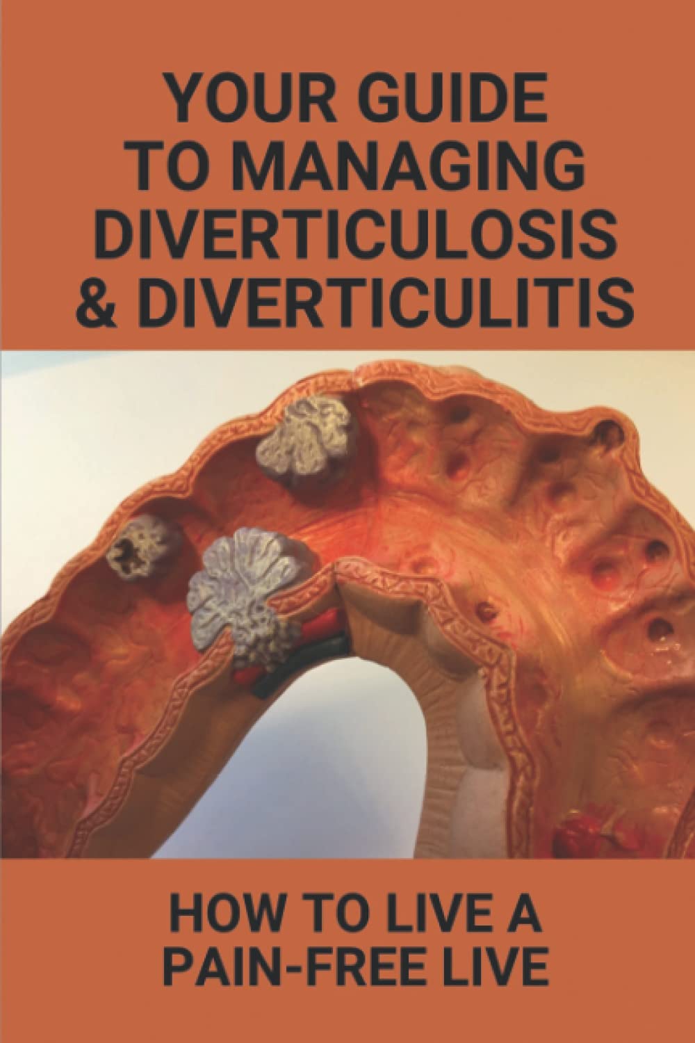Your Guide To Managing Diverticulosis & Diverticulitis: How To Live A ...