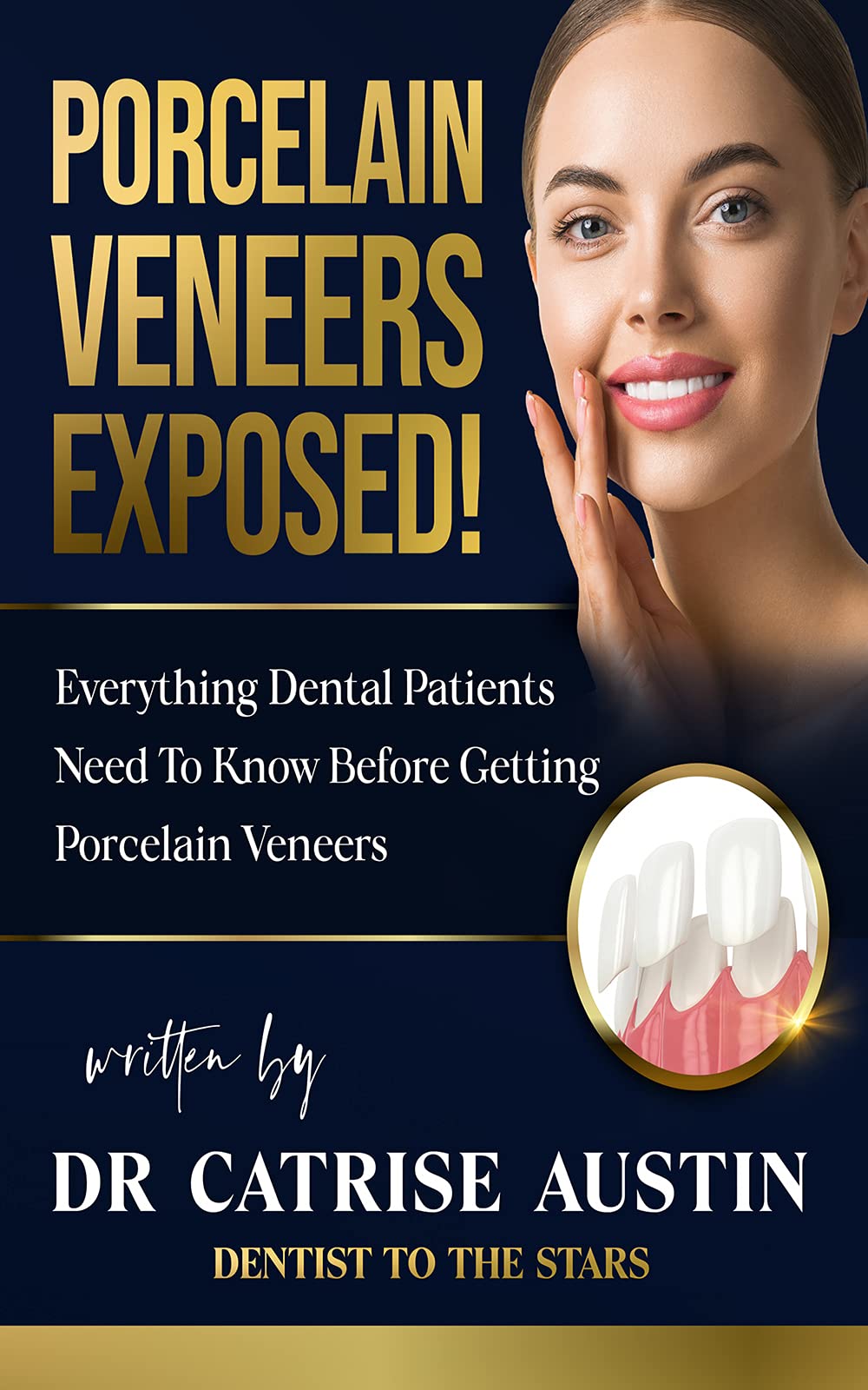 Porcelain Veneers Exposed! Everything Dental Patients Need To Know Before Getting Porcelain