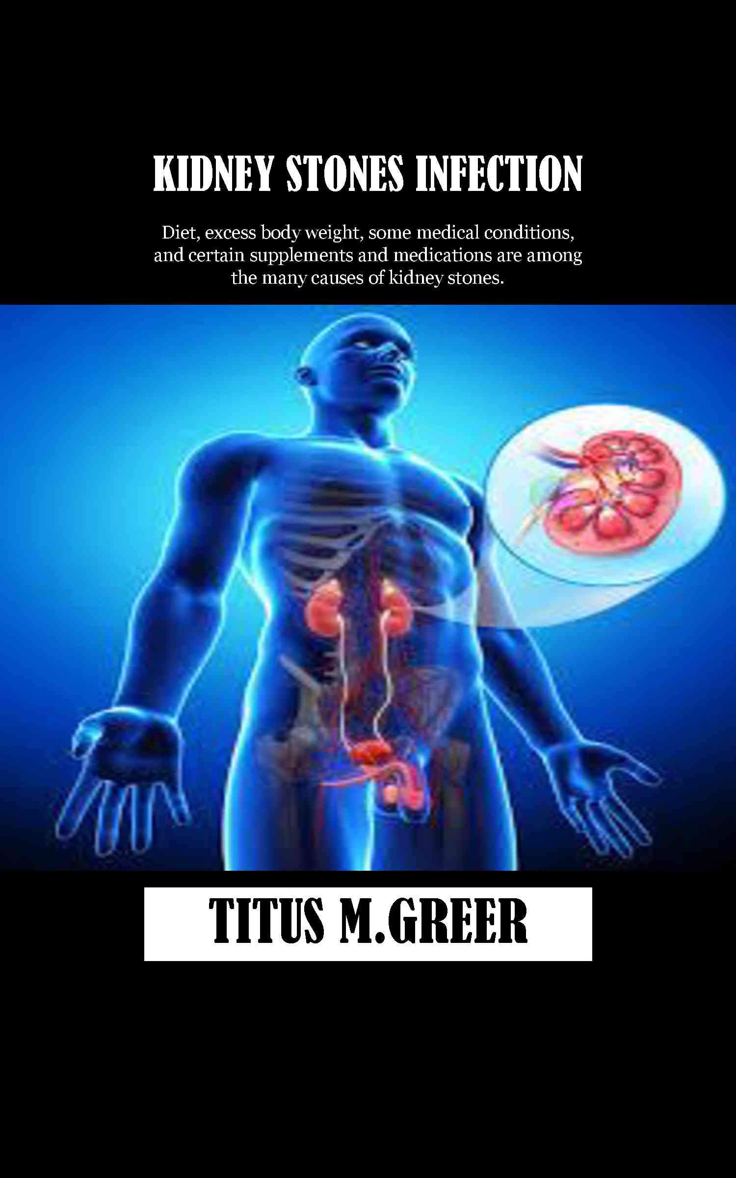 KIDNEY STONES INFECTION Diet, excess body weight, some medical