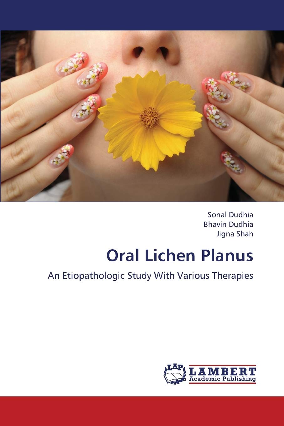 Oral Lichen Planus An Etiopathologic Study With Various Therapies by