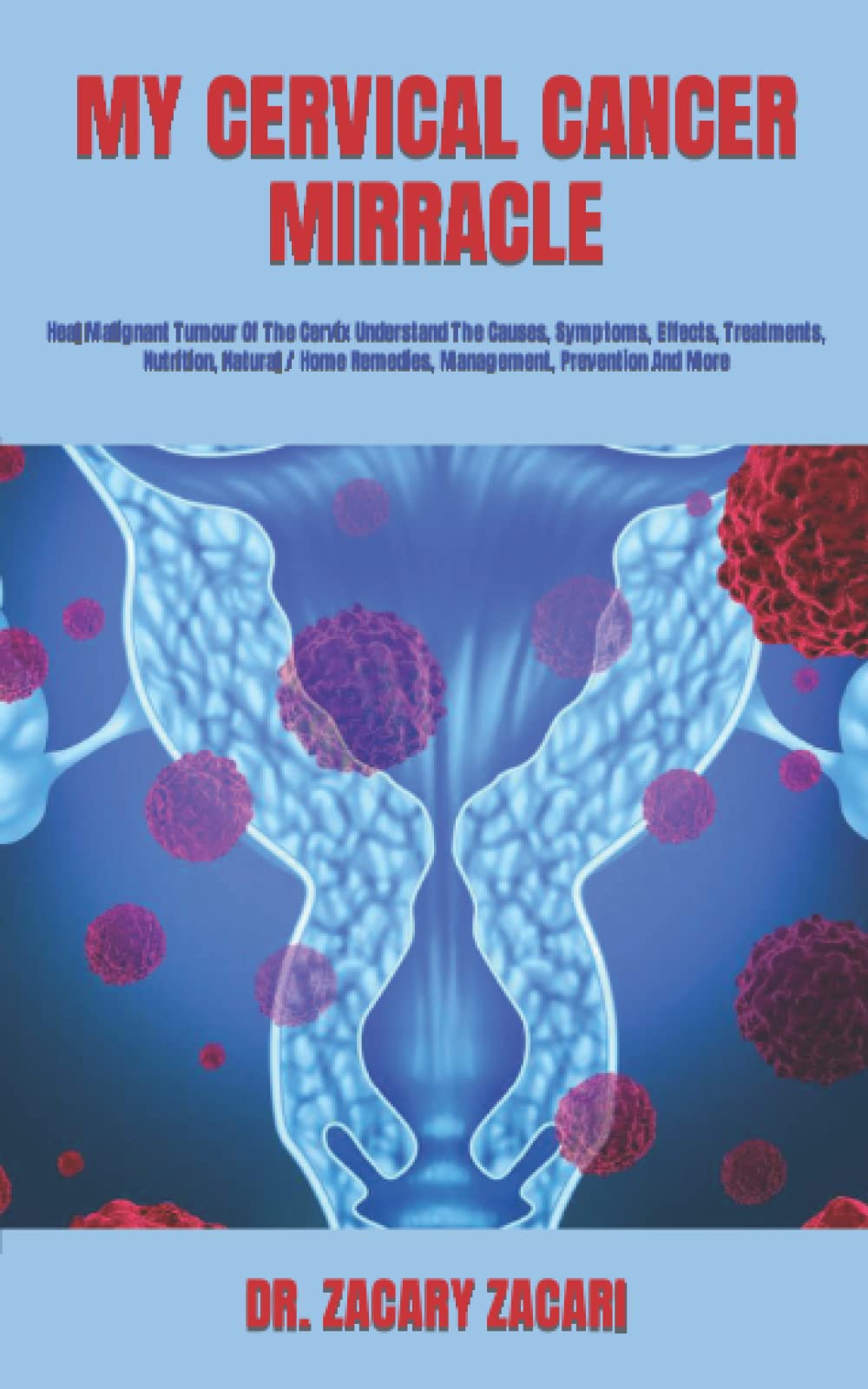 MY CERVICAL CANCER MIRRACLE Heal Malignant Tumour Of The Cervix